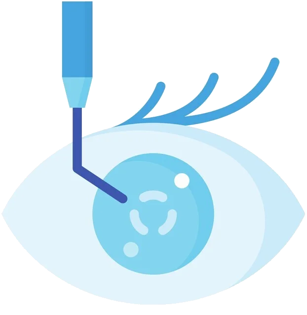 Vector image of eye showing cataract surgery with medical equipment