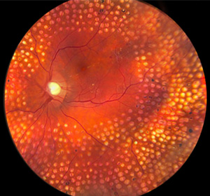 internal eye image showing dots